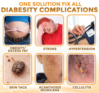 🐝 flysmus® Bee Venom Nodular Acupoint Stimulating Patch 🧑‍⚕️ Treats Diabesity, Obesity, High Blood Sugar Level